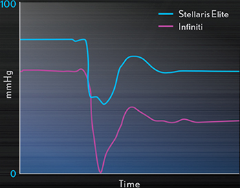 STELLARIS ELITE VS. INFINITI